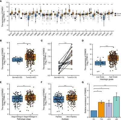 PSMD2 promotes the progression of bladder cancer and is correlated with immune infiltration